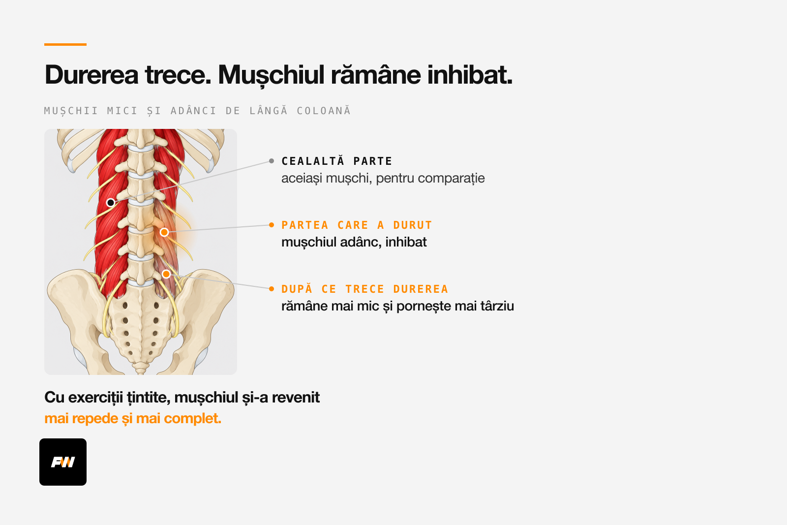 Coloana văzută din spate: mușchii mici și adânci de lângă ea, mai mici și inhibați pe partea care a durut, chiar după ce durerea a trecut