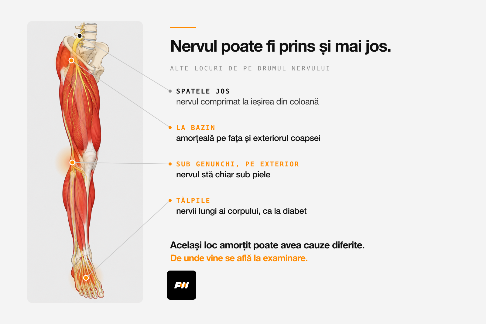 Piciorul cu nervii lui și locurile în care nervul poate fi prins: în spate, la bazin, sub genunchi și în tălpi
